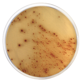 E. coli O157:H7 Cromogenic Agar Base Condalab 1588